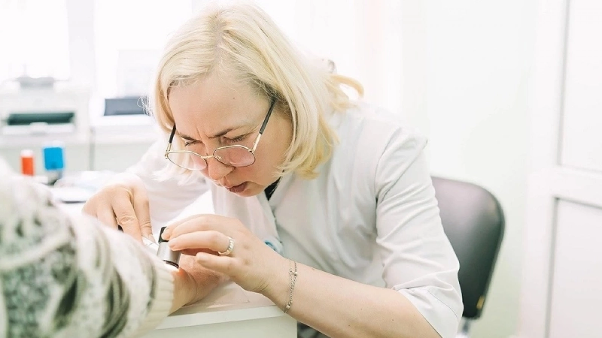 У кировчан онкологи бесплатно проверят родинки