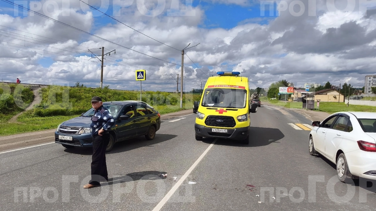 В Кирове женщина-пешеход получила серьезные травмы в ДТП на дороге в Нововятск