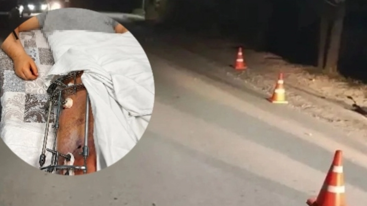 "Один весь переломан, второй - в коме": в Юрье водитель Camry сбил двух детей и бросил их раненых на дороге