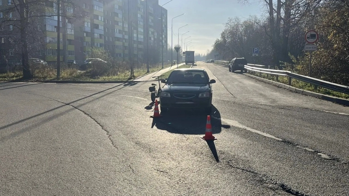 В Кирове иномарка наехала на 45-летнюю женщину на электросамокате