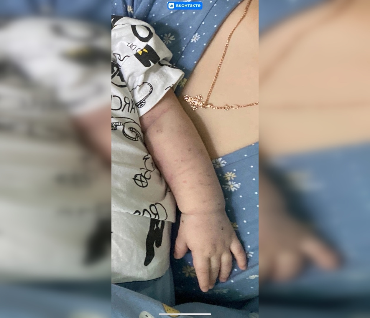 "Слушала за дверью плач сына": кировчанка о том, как ее малыша истыкали иглой в больнице