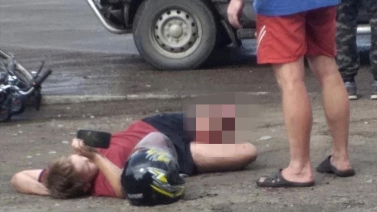 В день ВМФ в Кировской области сбили парня на мопеде: у ребенка переломы, один открытый